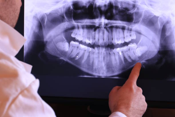 Best Knocked-Out Tooth Emergency  in Sunriver, OR