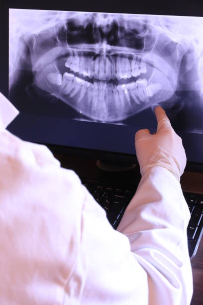 Best Emergency Tooth Extraction  in Sunriver, OR